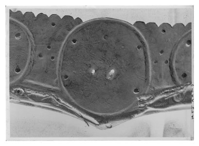 Höftskena - Livrustkammaren - 18251-negative