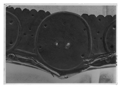 Höftskena - Livrustkammaren - 9689-negative