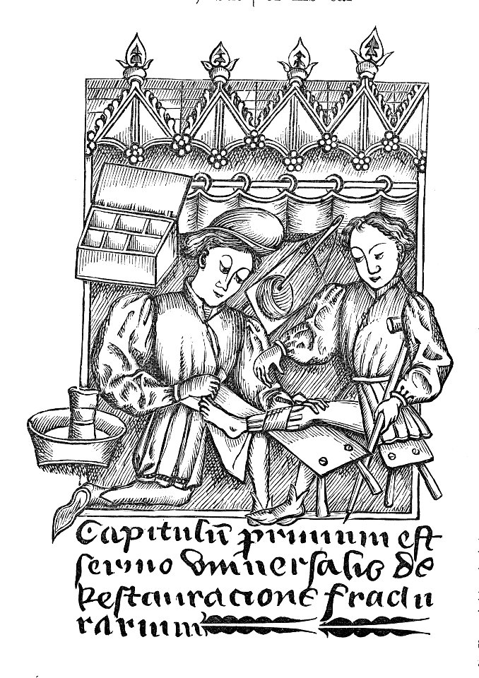 Illustration from a fourteenth century MS in on surgery in the City Library Bristol 2