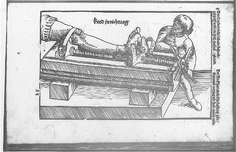 Illustrations in Feldtbuch der Wundartzney(BNF) 009
