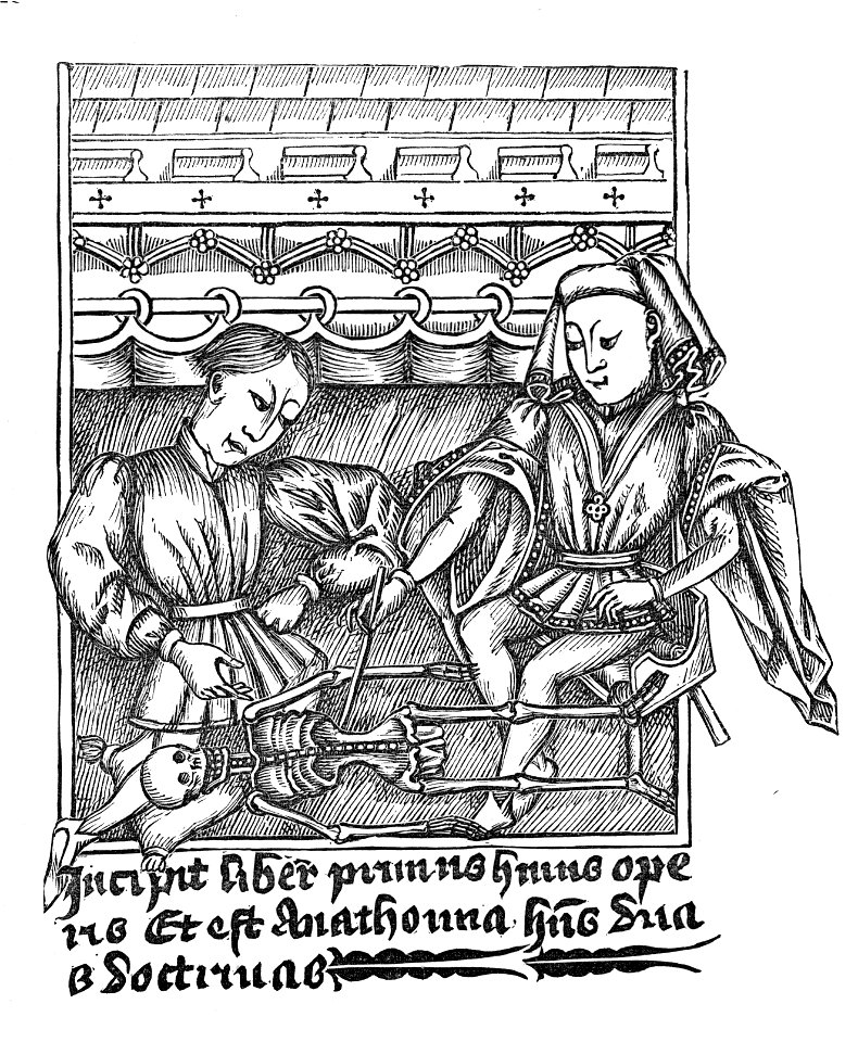 Illustration from a fourteenth century MS in on surgery in the City Library Bristol