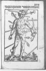 Illustrations in Feldtbuch der Wundartzney(BNF) 002