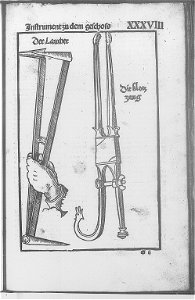 Illustrations in Feldtbuch der Wundartzney(BNF) 015