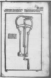 Illustrations in Feldtbuch der Wundartzney(BNF) 019