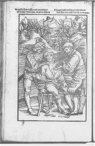 Illustrations in Feldtbuch der Wundartzney(BNF) 011