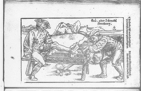 Illustrations in Feldtbuch der Wundartzney(BNF) 008