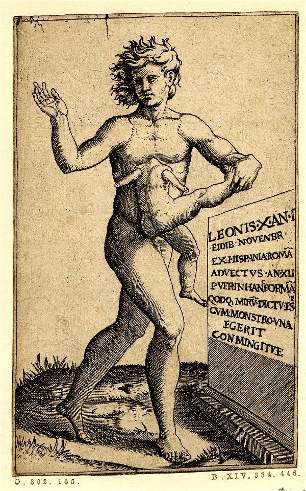 Marcantonio - A deformed young man, nude, with a headless young child's body attached by the neck to the chest of the young man, 1854,0513.42