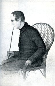 Ludwig Harms Scan