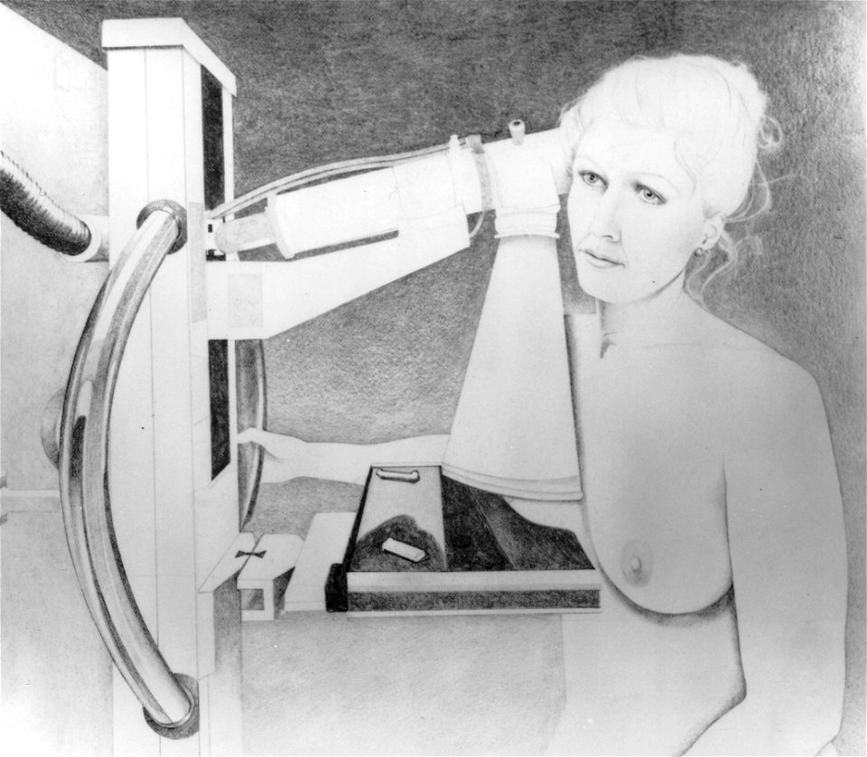 Mammography (5)