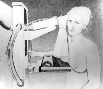 Mammography (5)