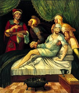 Milagro de San Cosme y San Damián, de Juan Correa de Vivar (Museo de Navarra)