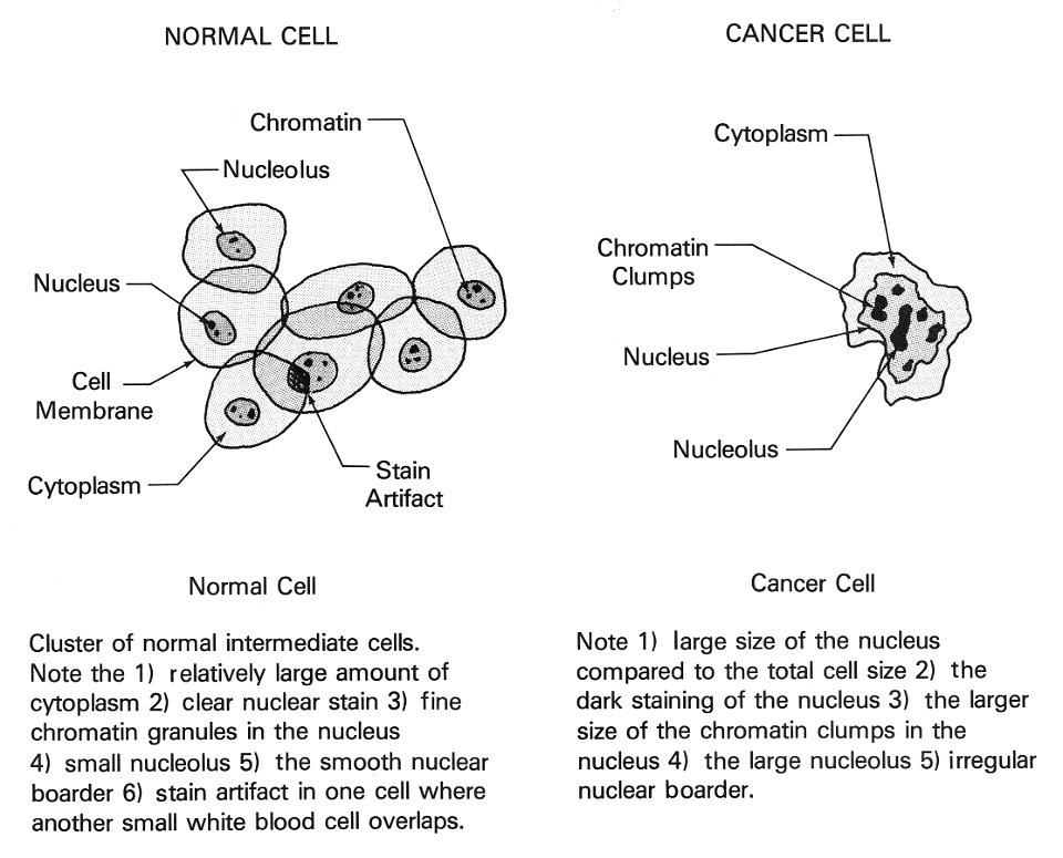 Normal and cancer cells illustration