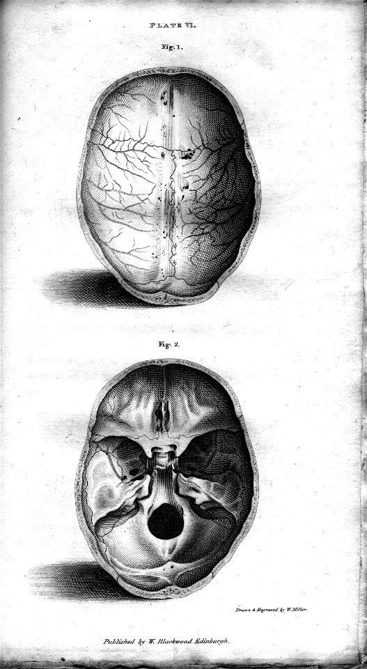 Plate VI Human Skull, engraving by William Miller after drawing by W Miller