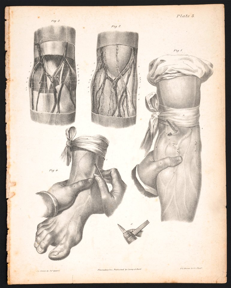 Plate 3 - on stone by Jas. Queen ; P.S. Duval Lith. Phila. LCCN2014649311
