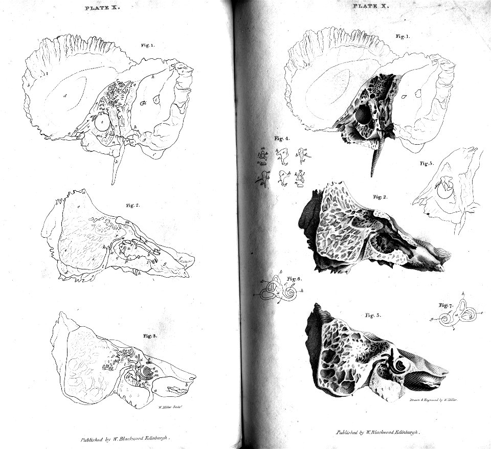 Plate X Human Skull, engraving by William Miller after drawing by W Miller