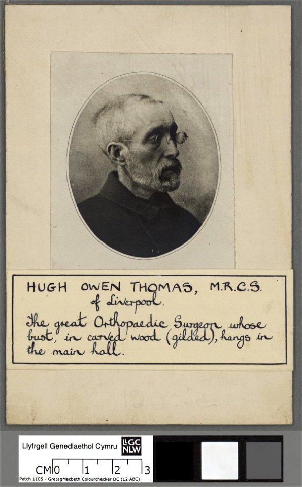 Portrait of Hugh Owen Thomas, M.R.C.S. of Liverpool (4671477)