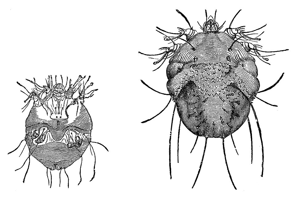 PSM V08 D701 Sarcoptes scabieis