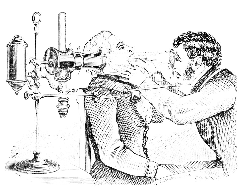 PSM V12 D182 Laryngeal examination