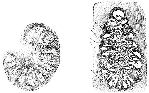 PSM V20 D474 Spiracle of a cockchafer grub and a fly