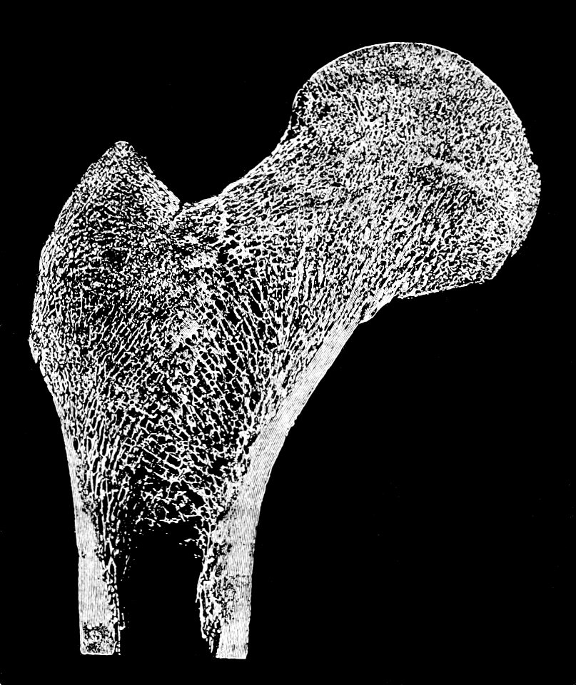 PSM V42 D775 Femur fibre arrangement for strength