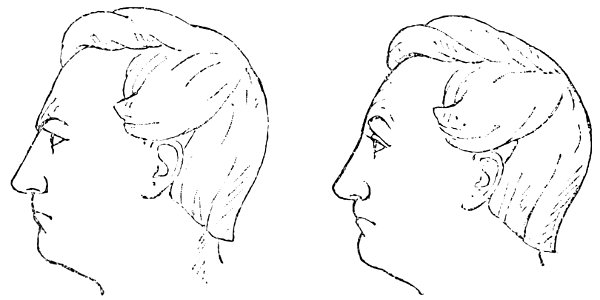 PSM V36 D702 Two pinched facial expressions