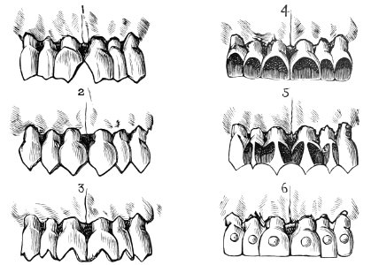 PSM V39 D509 Malaysian examples of tooth filing. Free illustration for personal and commercial use.