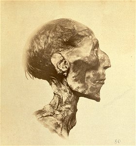 Ramses II mummy head view