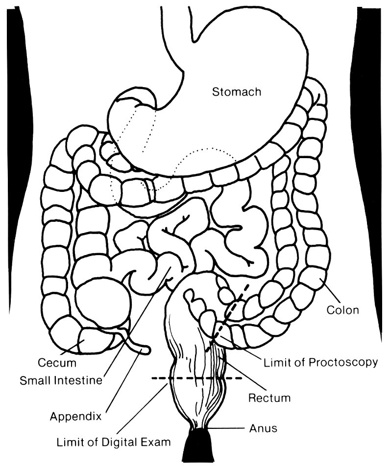 Rectal exam illustration