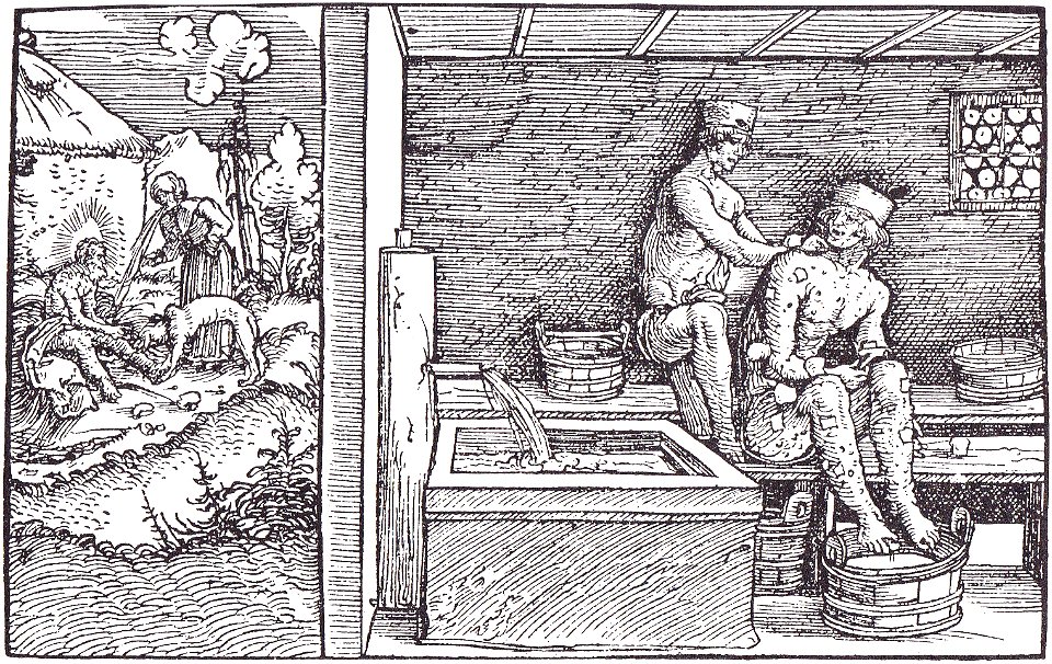 Scabies