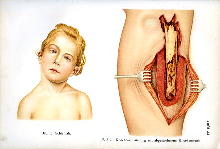 Siebert 22