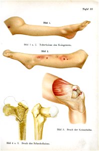 Siebert 23