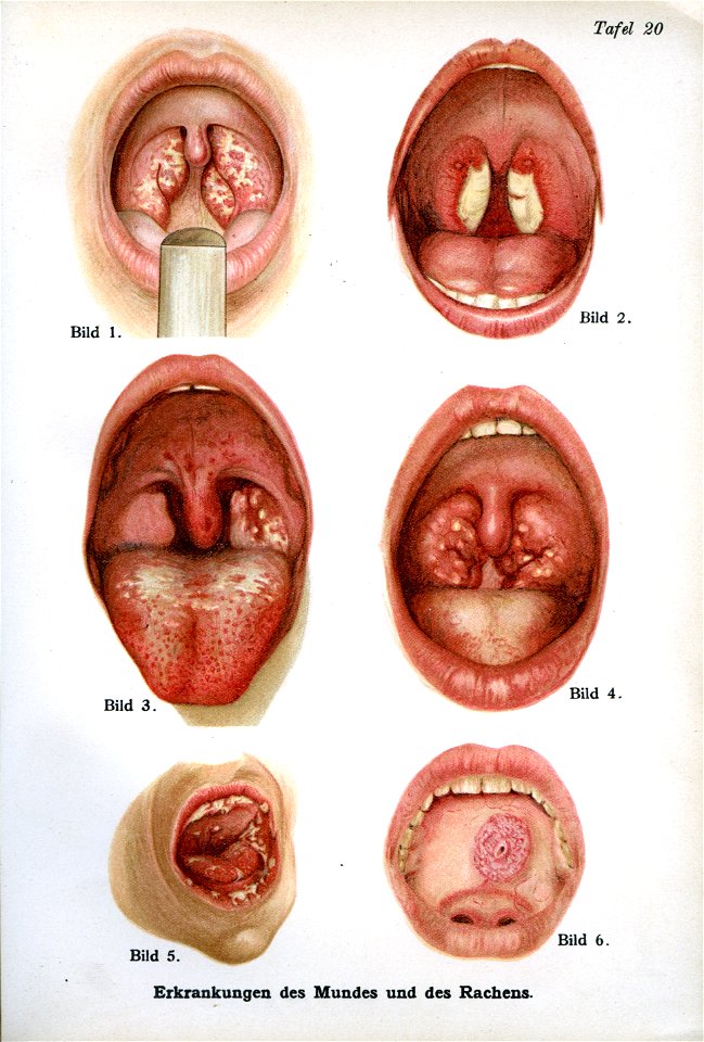 Siebert 14
