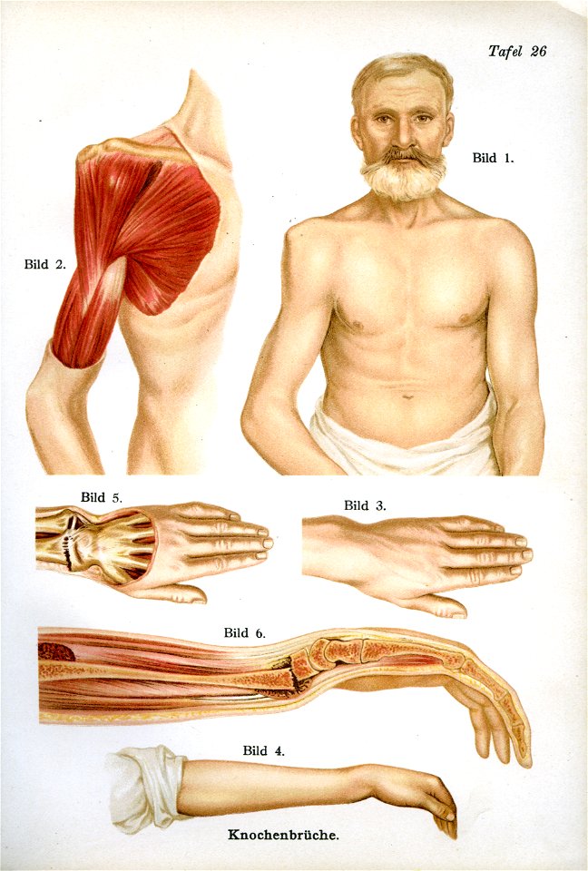 Siebert 18