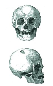 Skull form Ladánybene