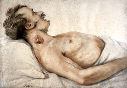 Soldier with neck wound, by Charles Bell Wellcome L0029937