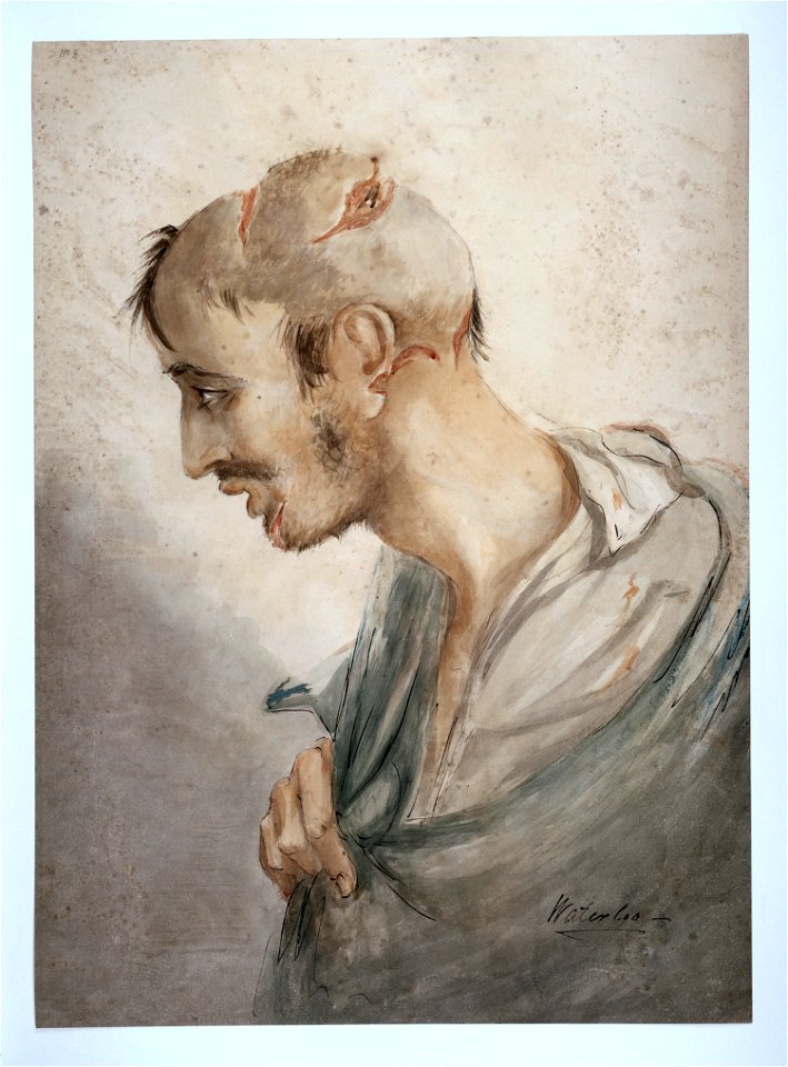 Soldier with head & facial injuries, C. Bell Wellcome L0029936
