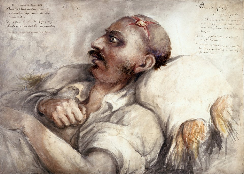 Soldier with head wound, by Charles Bell Wellcome L0029938
