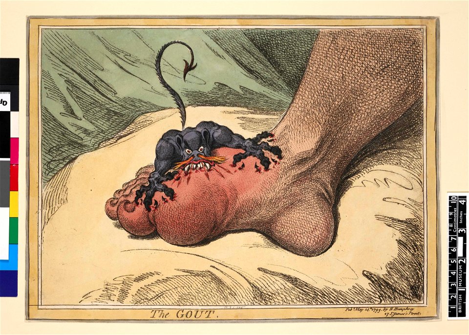 The Gout (BM 1851,0901.980)