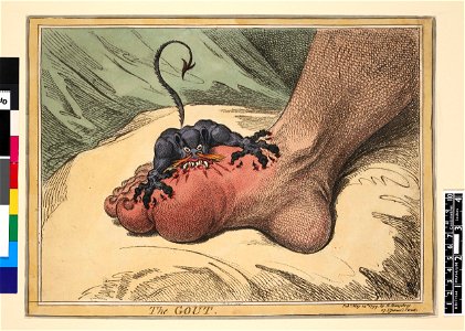 The Gout (BM 1851,0901.980)