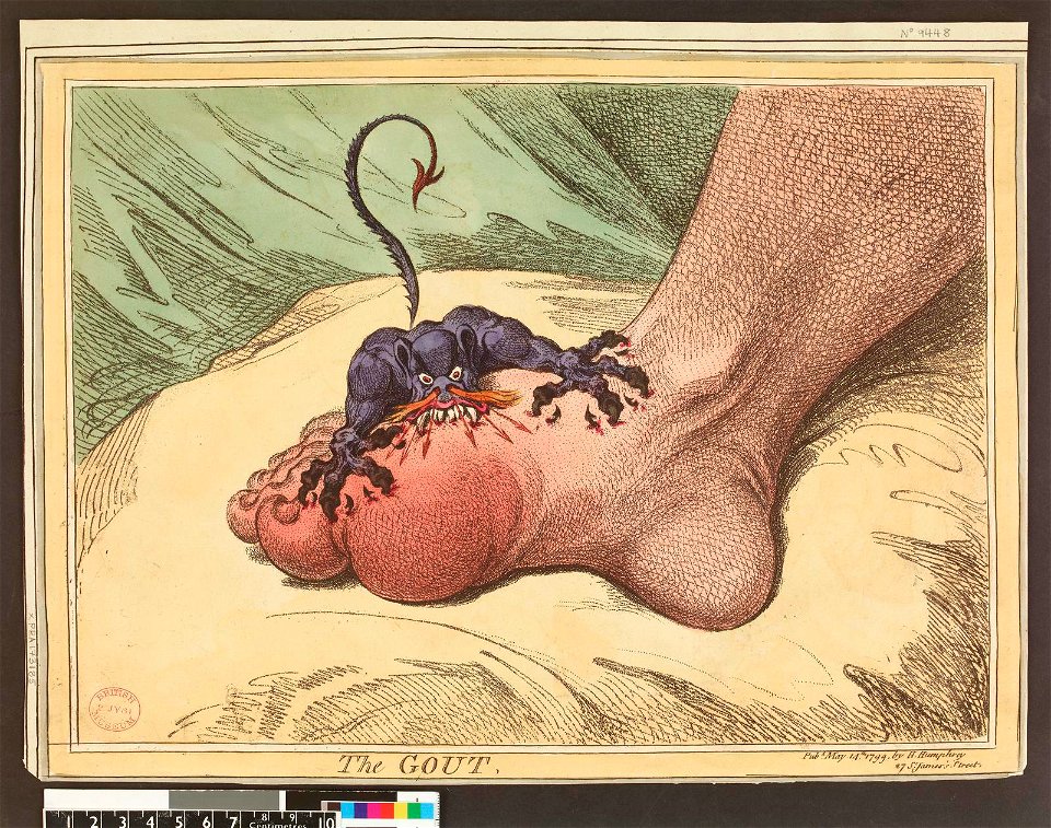 The Gout (BM 1935,0522.4.34 1)