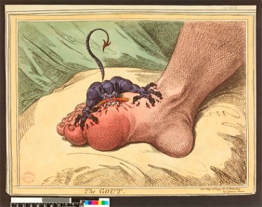 The Gout (BM 1935,0522.4.34 1)