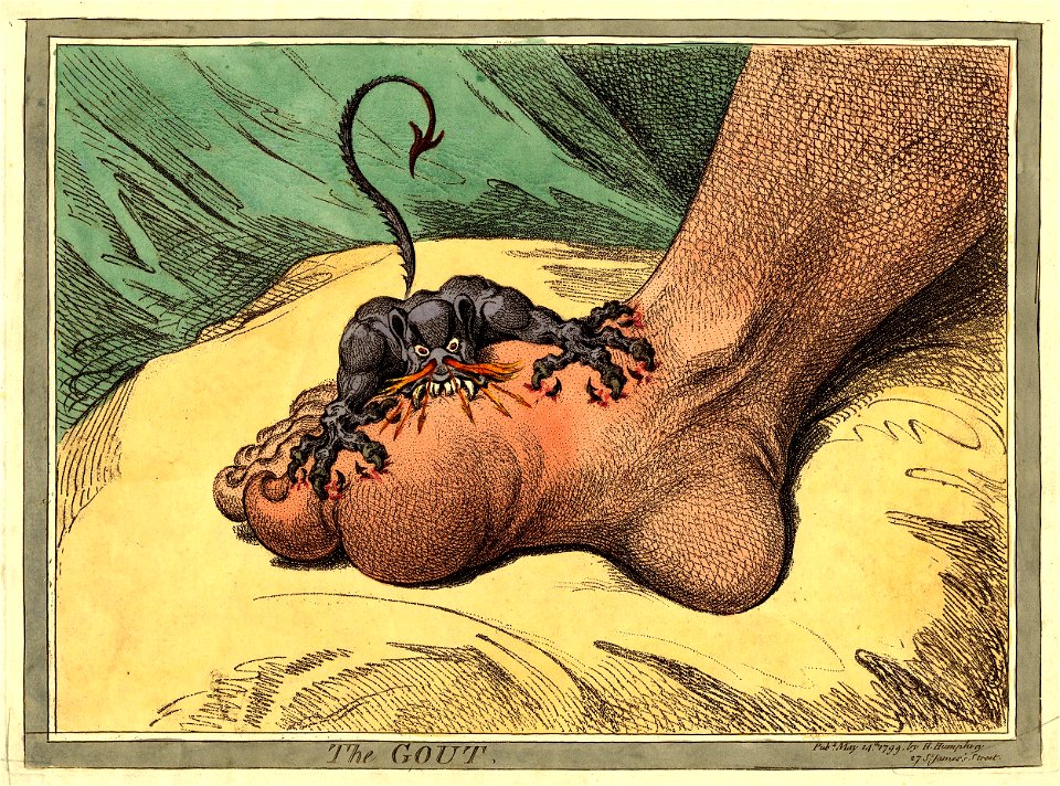 The Gout. (BM 1868,0808.12522)