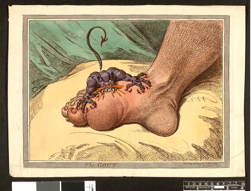 The Gout. (BM 1868,0808.12522 1)