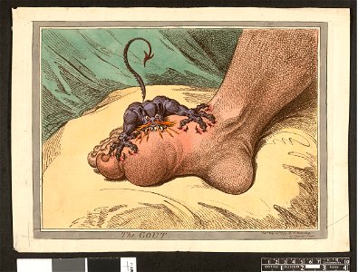 The Gout. (BM 1868,0808.12522 1)