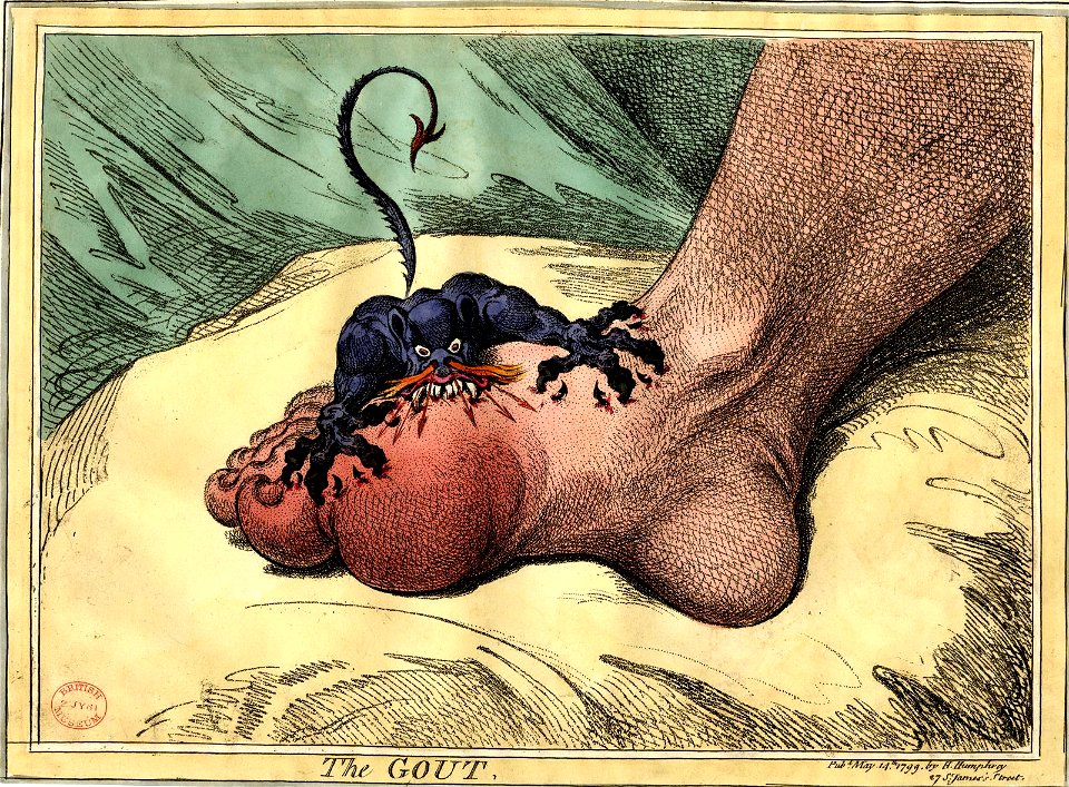 The Gout (BM 1935,0522.4.34)