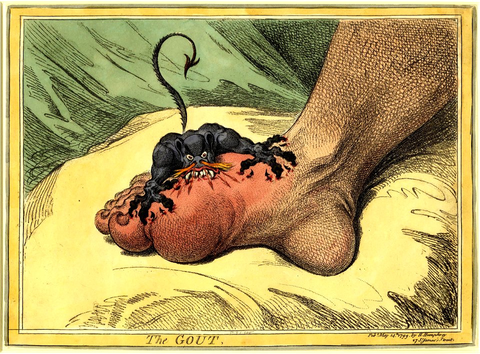 The Gout (BM 1851,0901.980 1)