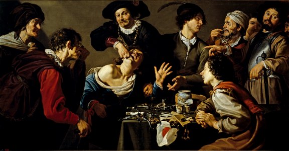 Theodoor Rombouts - The quack tooth puller. Free illustration for personal and commercial use.