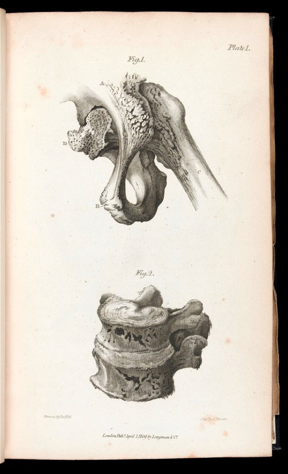 Thigh bone and vertebra Wellcome L0040760