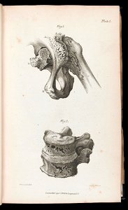Thigh bone and vertebra Wellcome L0040760