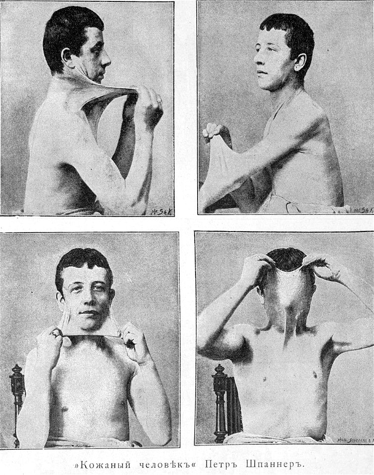 Шпаннер Пётр, 1891